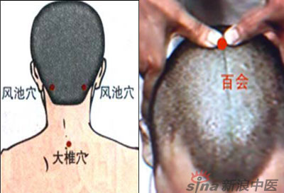 常見(jiàn)病艾灸時(shí)怎樣選穴？--大椎百會(huì)穴