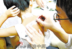 灸法的種類  你知道多少？