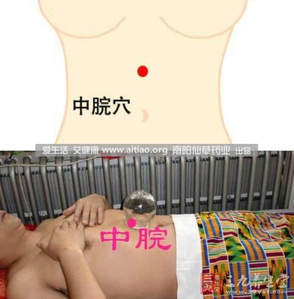 中脘穴位于腹部正中線，臍上4寸的位置上。每天艾灸10-15分鐘，能有效緩解胃部不適的癥狀，同時有助于祛濕。